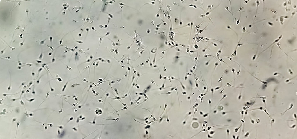 Spermiogramm: Untersuchung der Spermien des Mannes