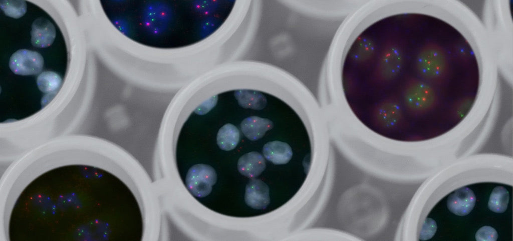 Pränataldiagnostik: Methoden, Möglichkeiten, Kosten und ethische Aspekte