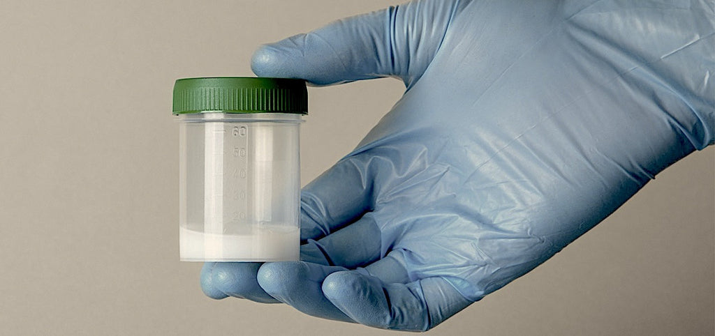 Die Bechermethode für künstliche Befruchtung